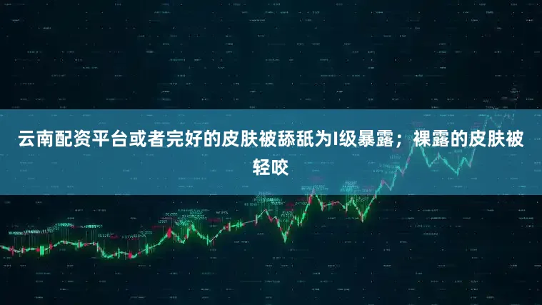 云南配资平台或者完好的皮肤被舔舐为I级暴露；裸露的皮肤被轻咬